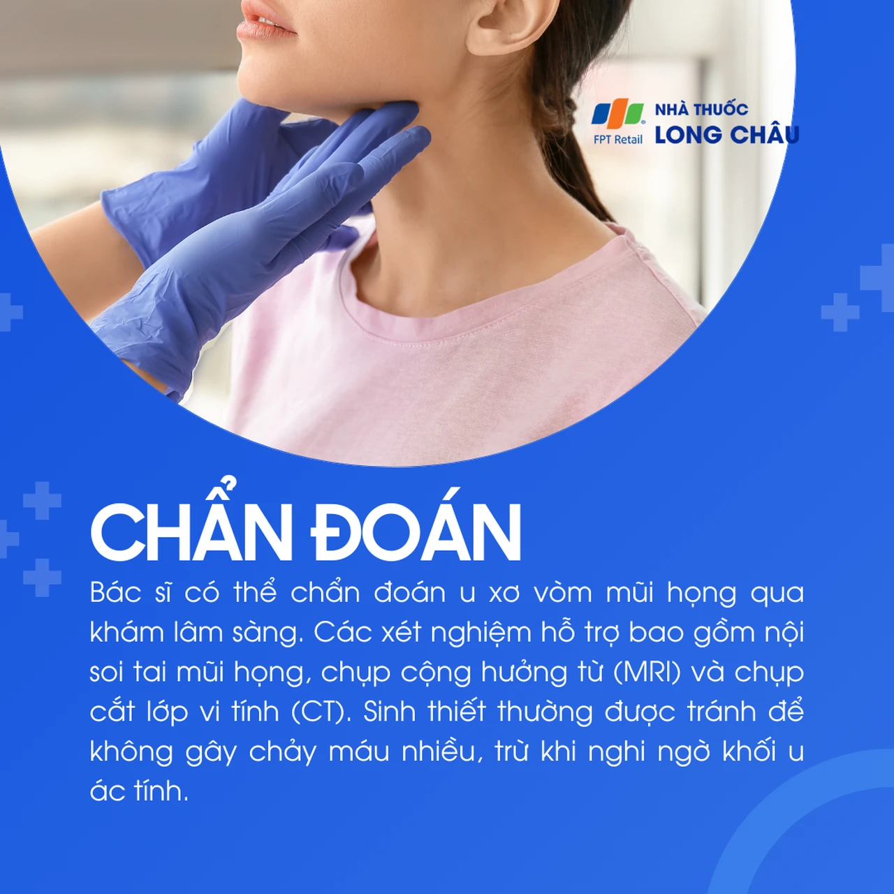 U xơ vòm mũi họng 5