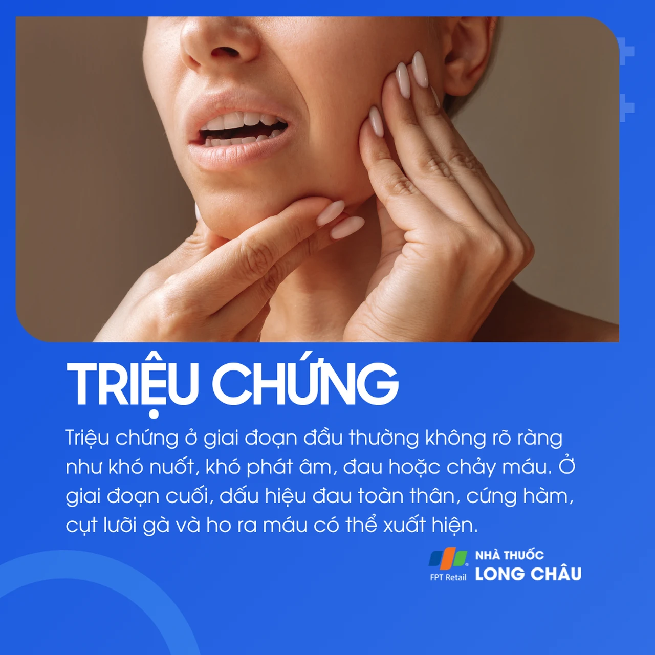 Ung thư amidan khẩu cái 2