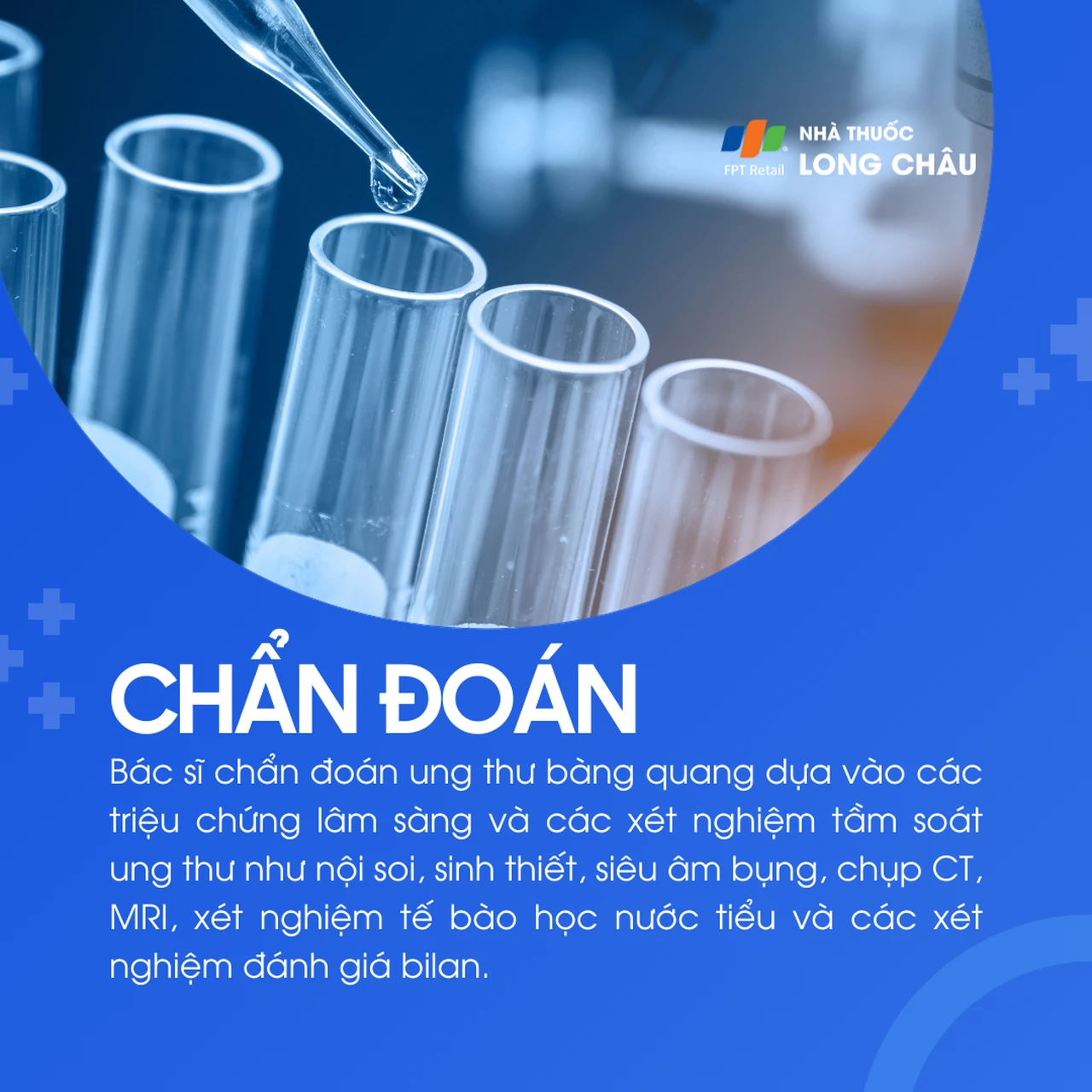 Ung thư bàng quang 5