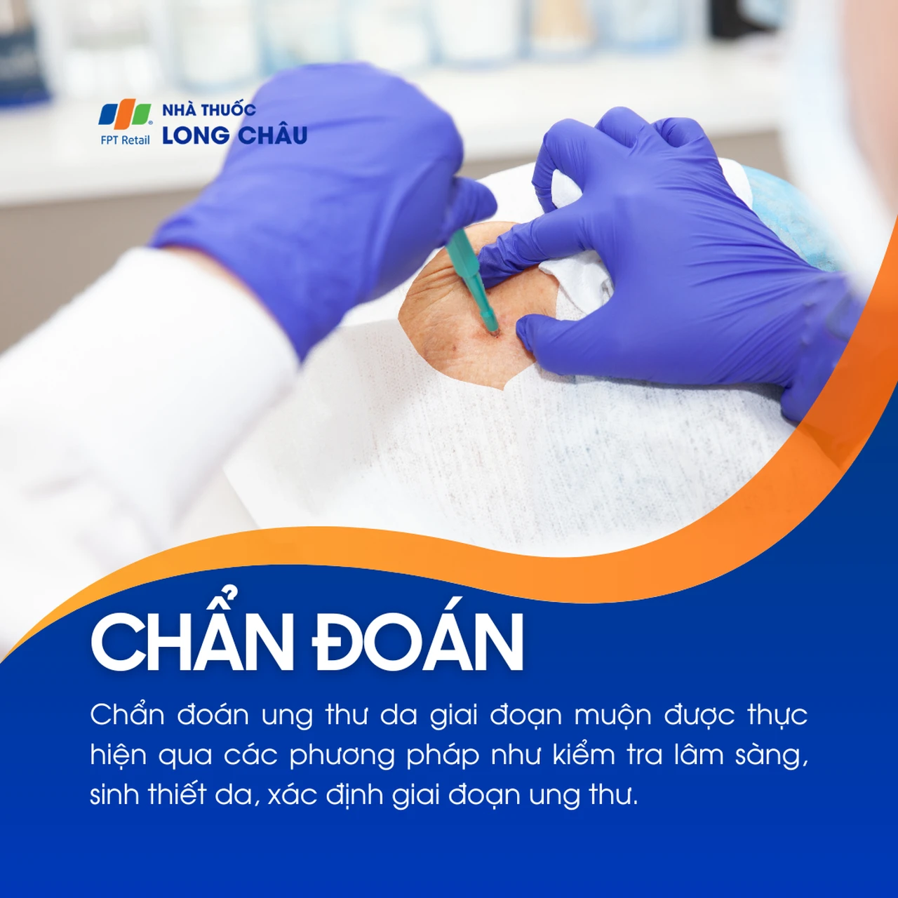Ung thư da giai đoạn muộn 5