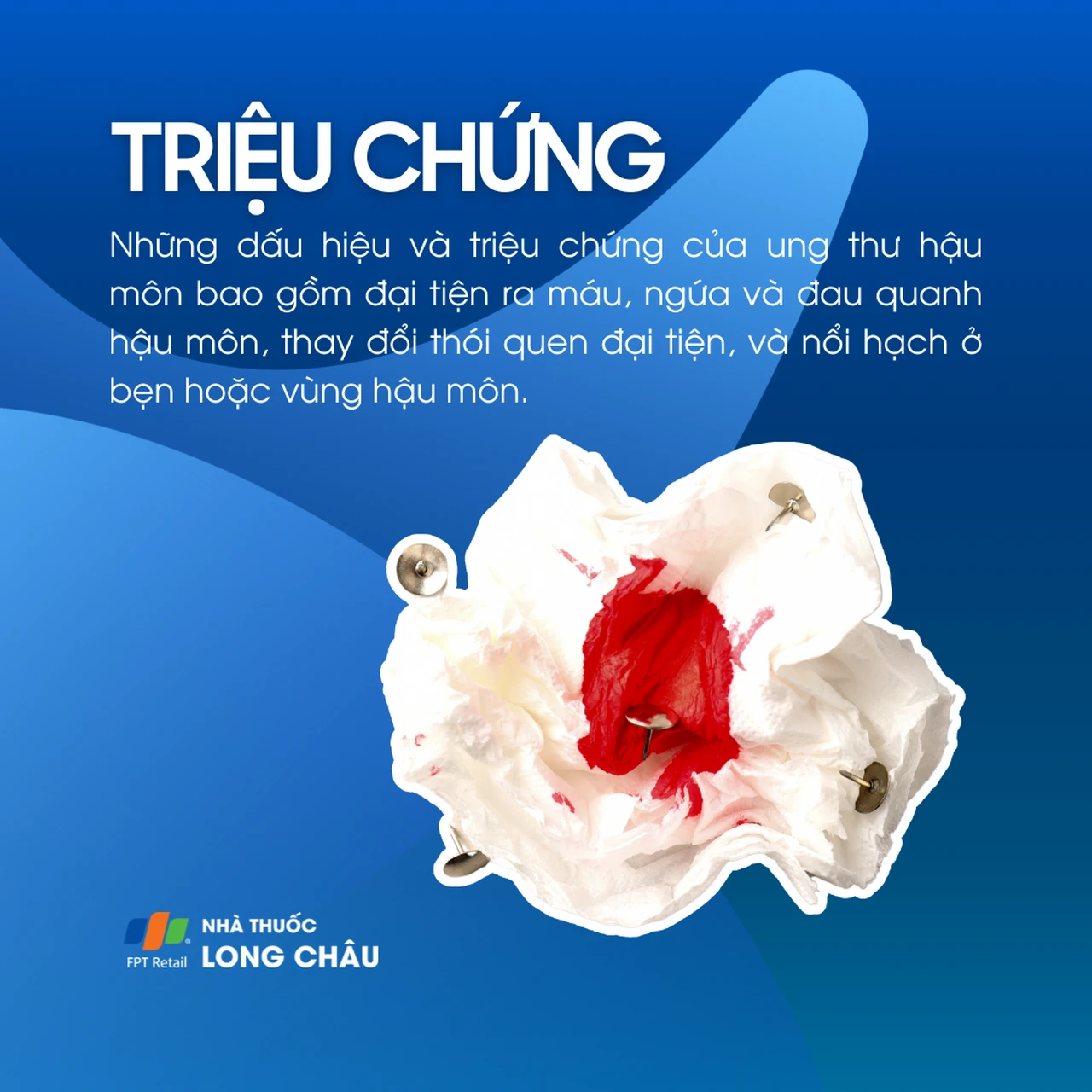 Ung thư hậu môn 2