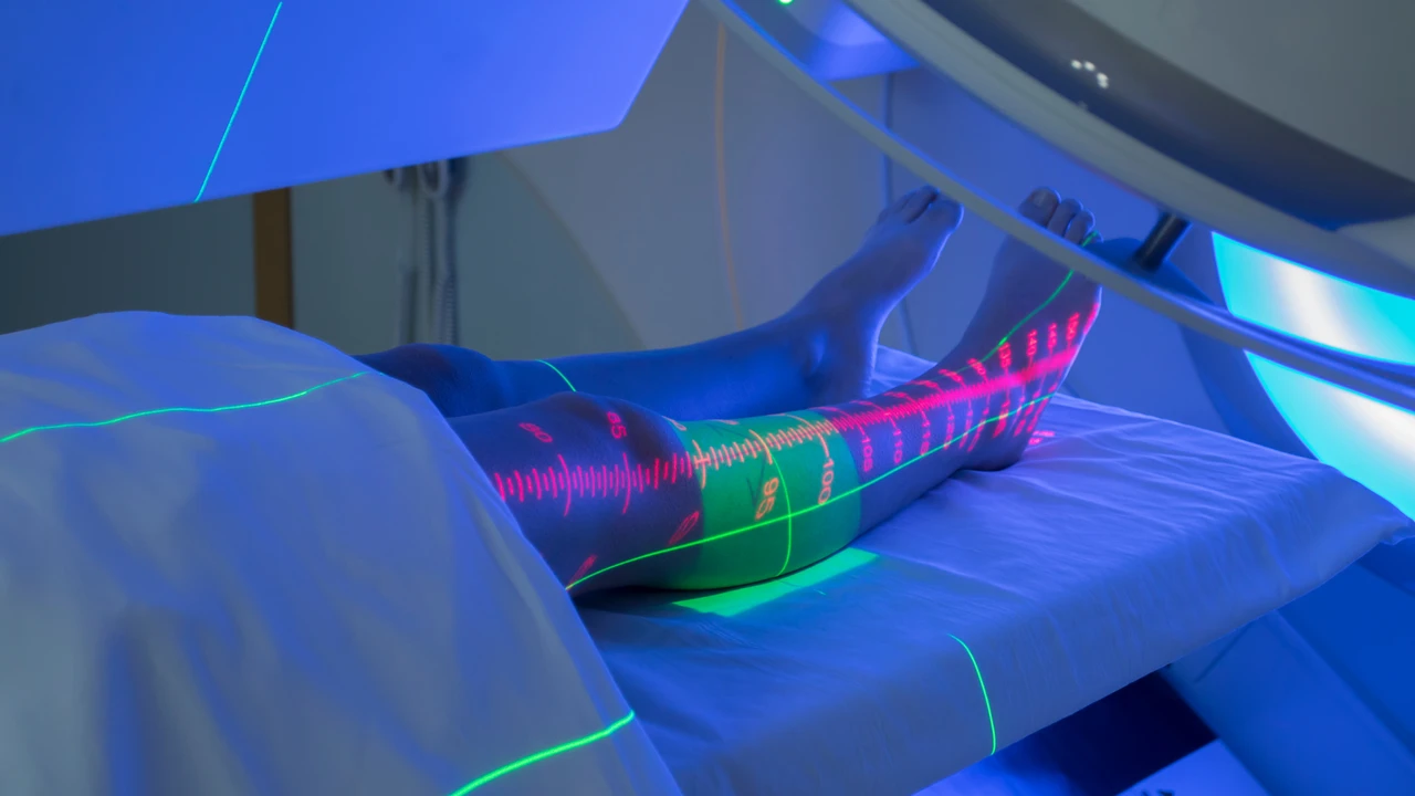 Ung thư mô liên kết 3