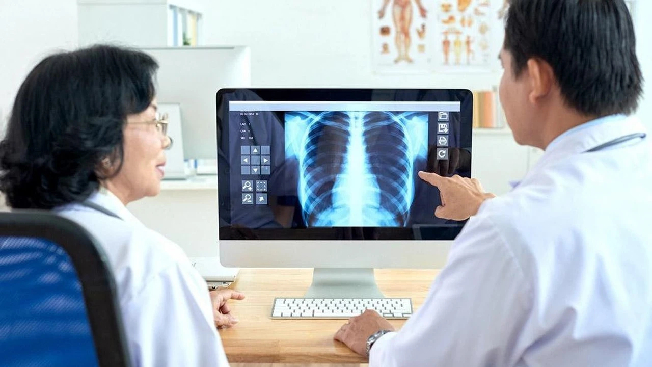 Ung thư phổi không tế bào nhỏ giai đoạn II: Hiểu rõ để điều trị tốt hơn 3