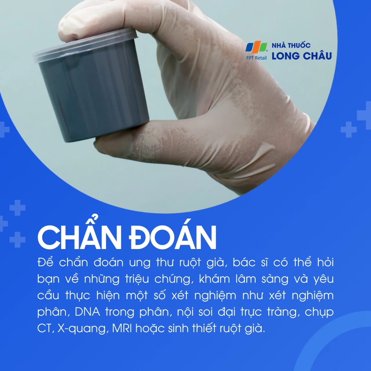 Ung thư ruột già 5