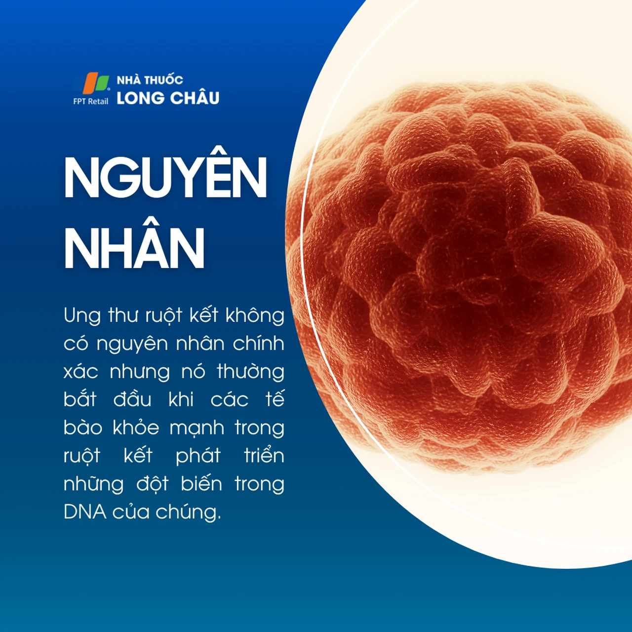 Ung thư ruột kết 3