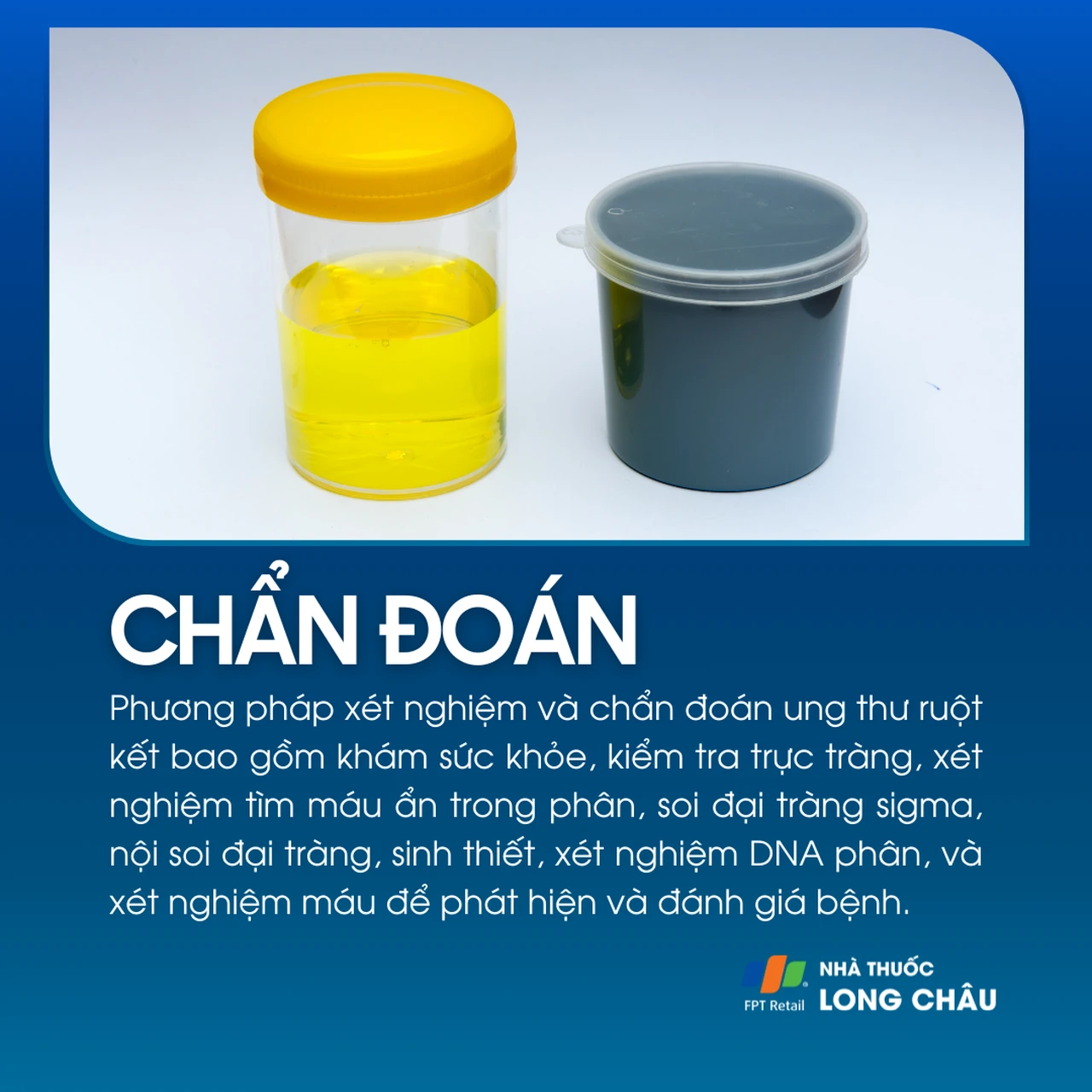 Ung thư ruột kết 5