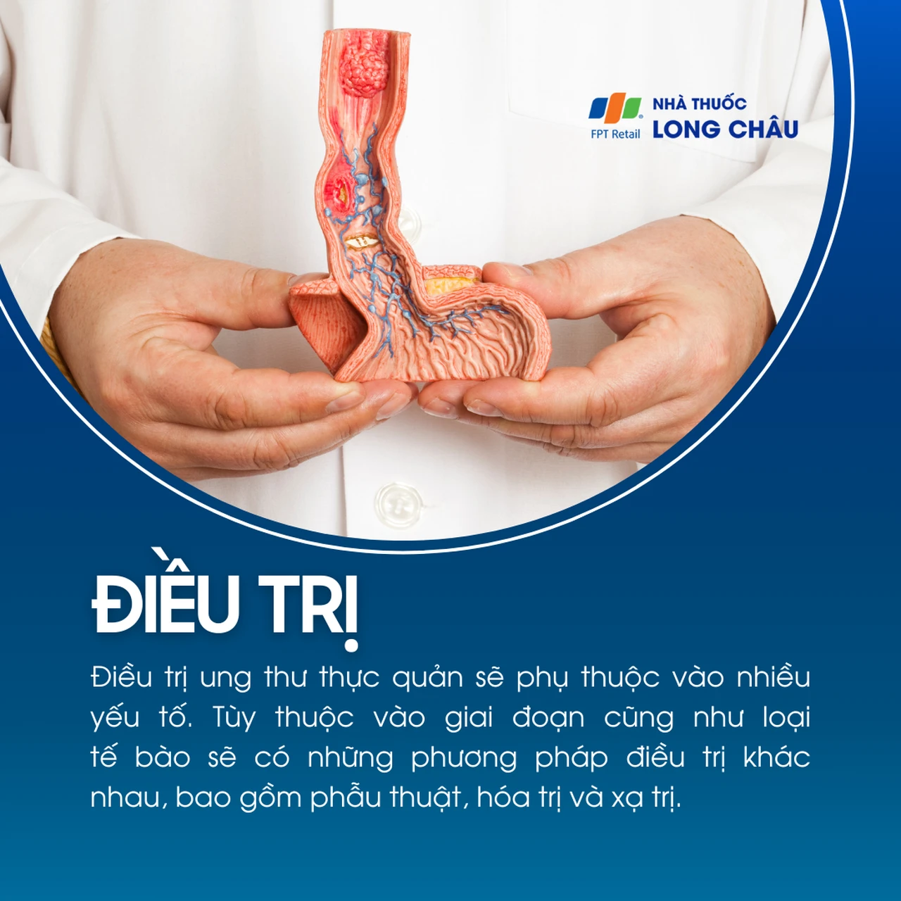 Ung thư thực quản 6