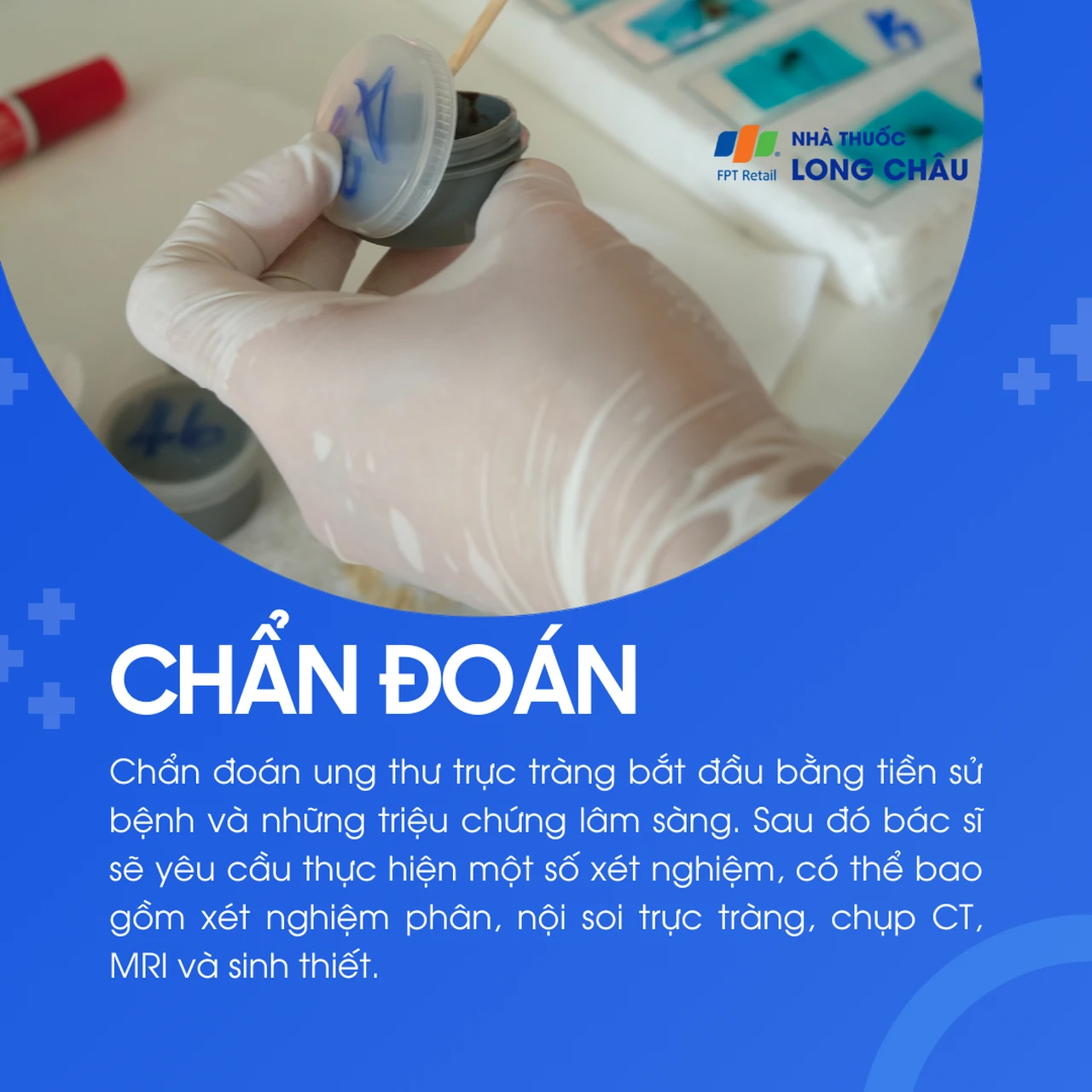 Ung thư trực tràng 5