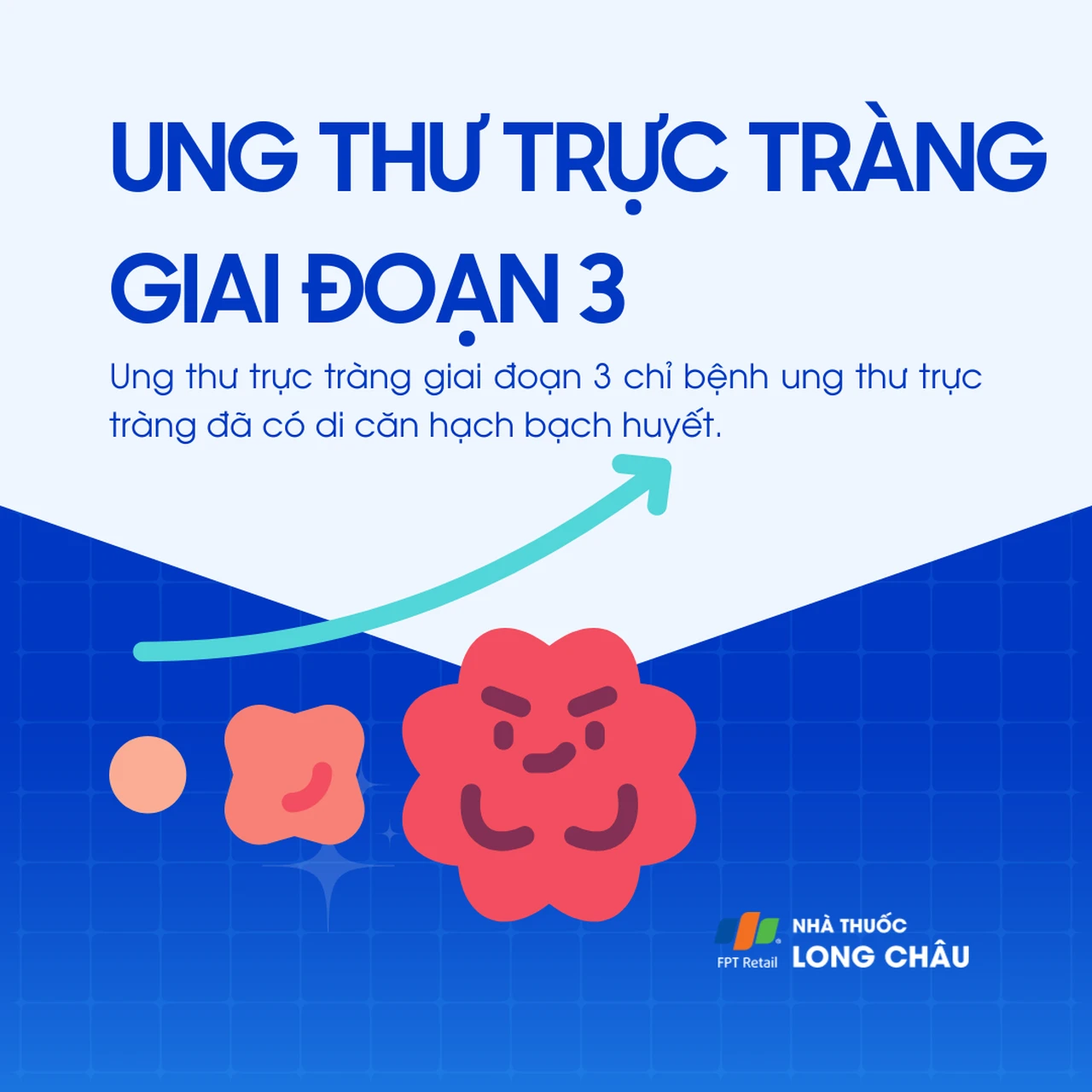 Ung thư trực tràng giai đoạn 3 1