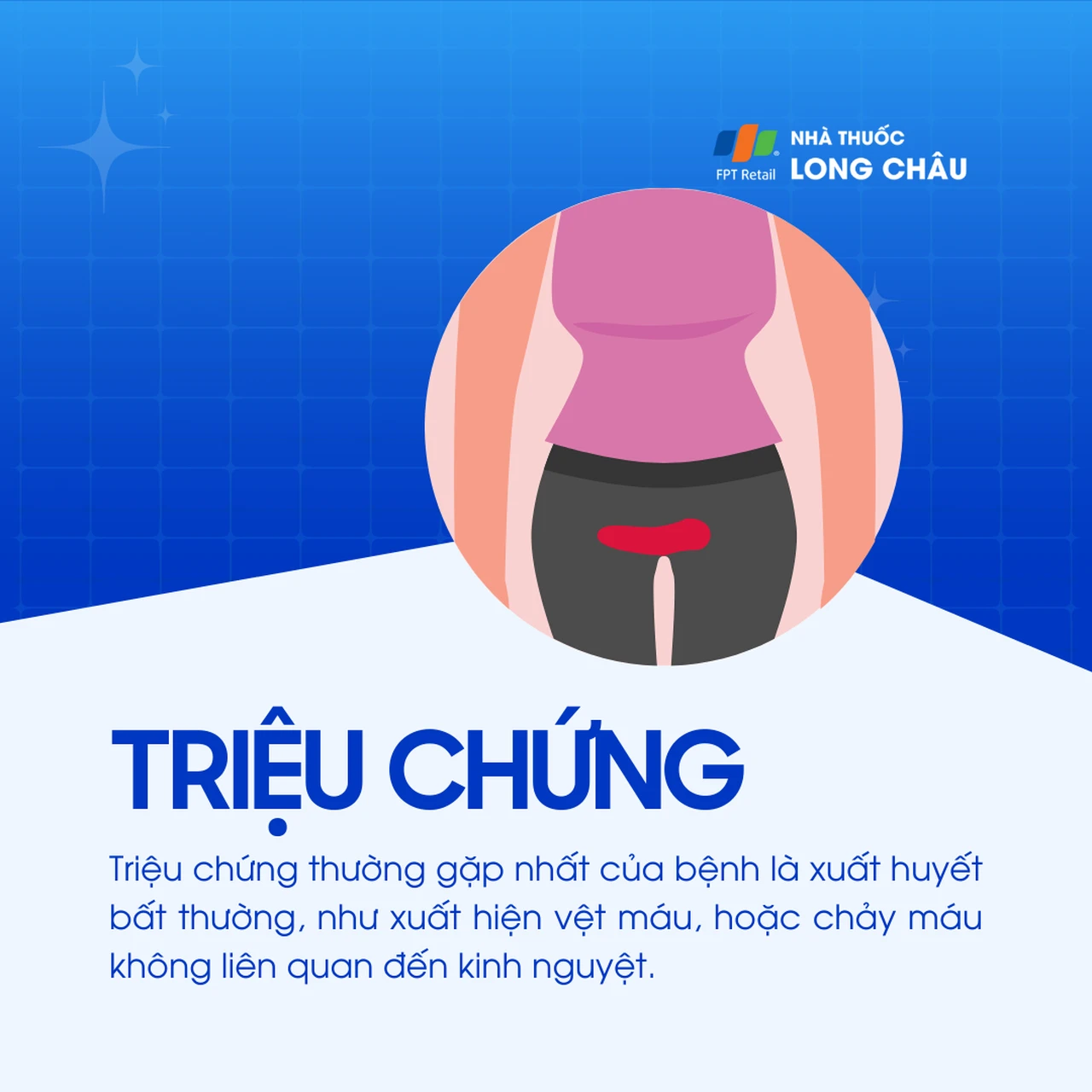 Ung thư tử cung giai đoạn 2 2