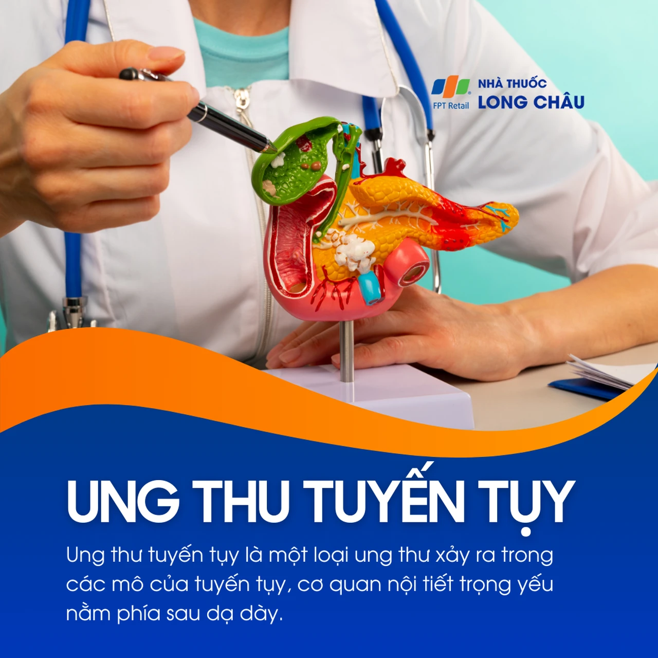 Ung thư tuyến tụy 1