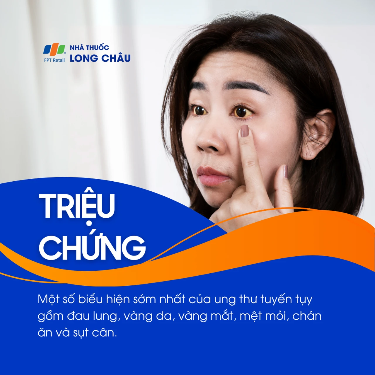 Ung thư tuyến tụy 2