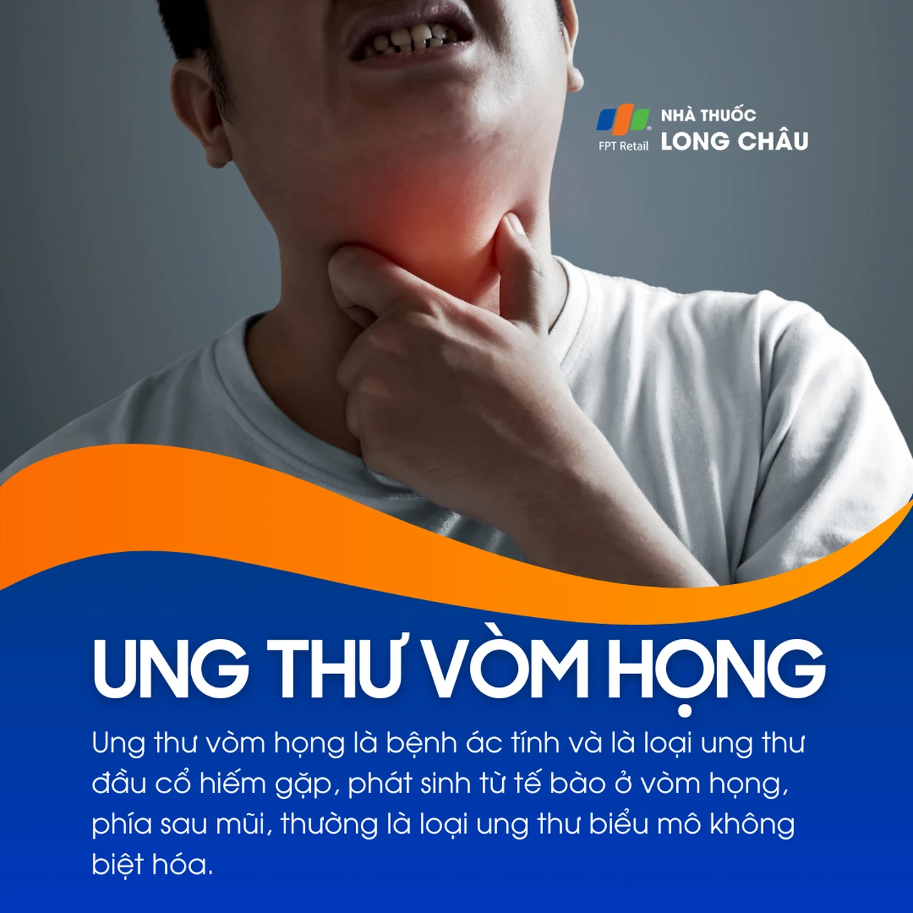 Ung thư vòm họng 1