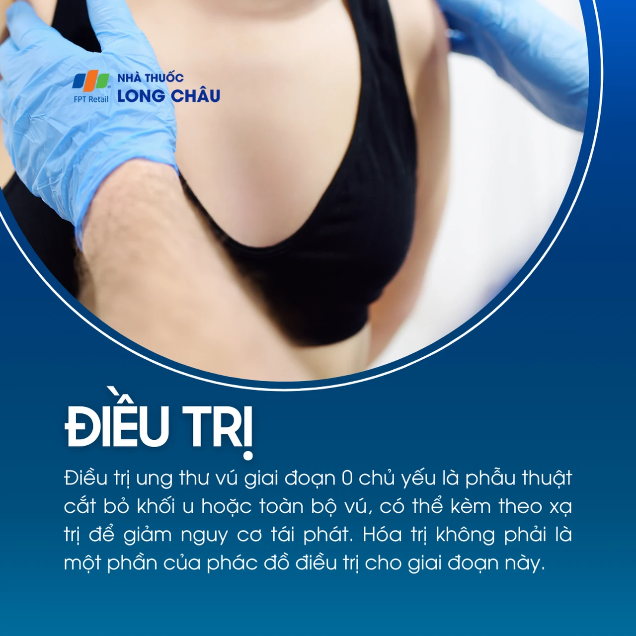 Ung thư vú giai đoạn 0 6