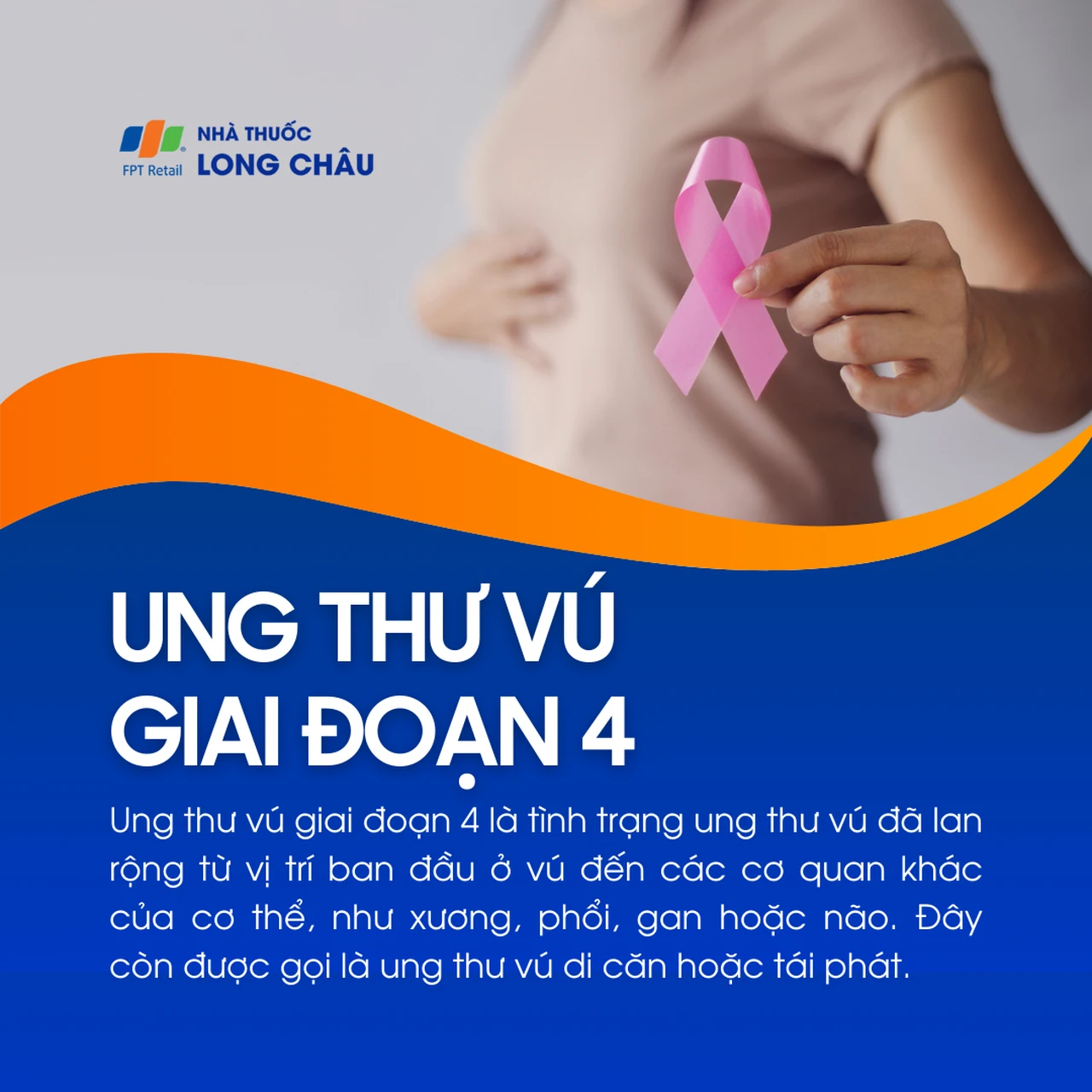 Ung thư vú giai đoạn 4 1