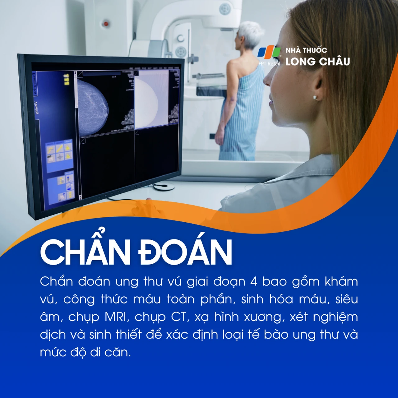 Ung thư vú giai đoạn 4 5