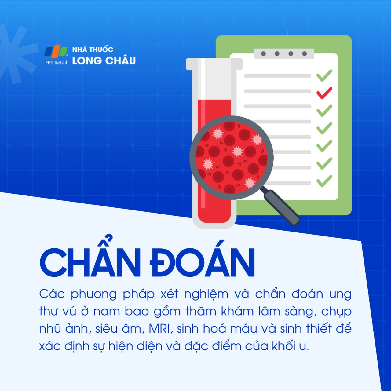 Ung thư vú ở nam 5