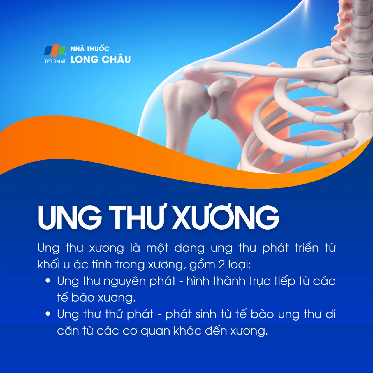 Ung thư xương 1