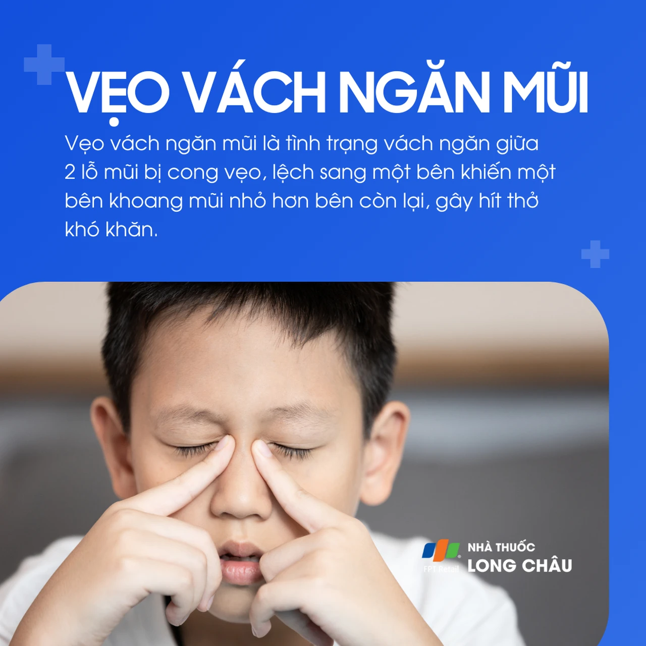 Vẹo vách ngăn mũi 1