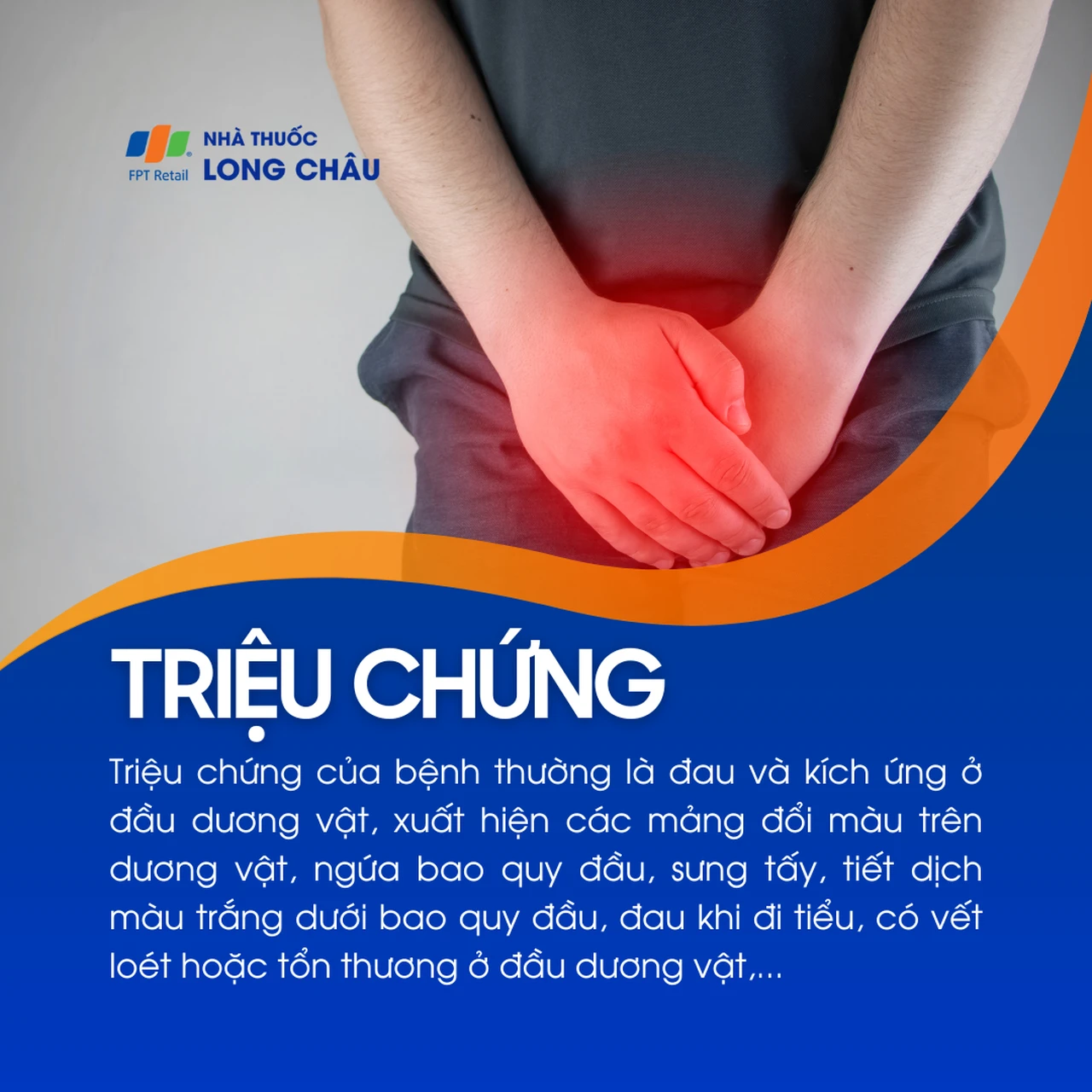 Viêm bao quy đầu 2