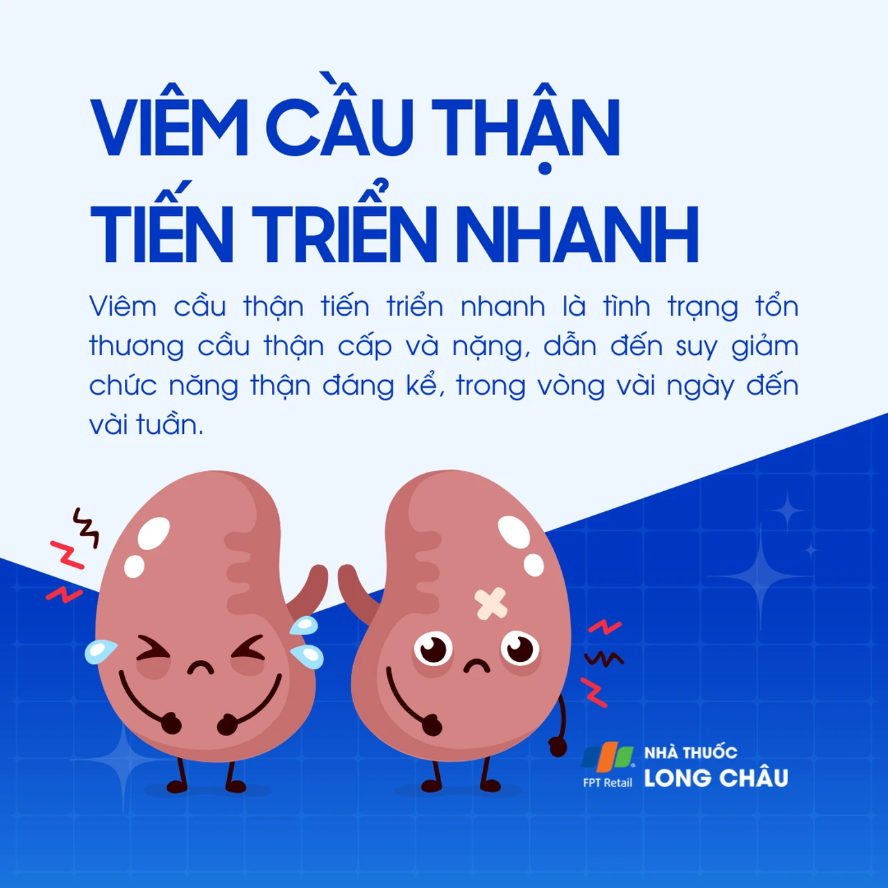 Viêm cầu thận tiến triển nhanh 1