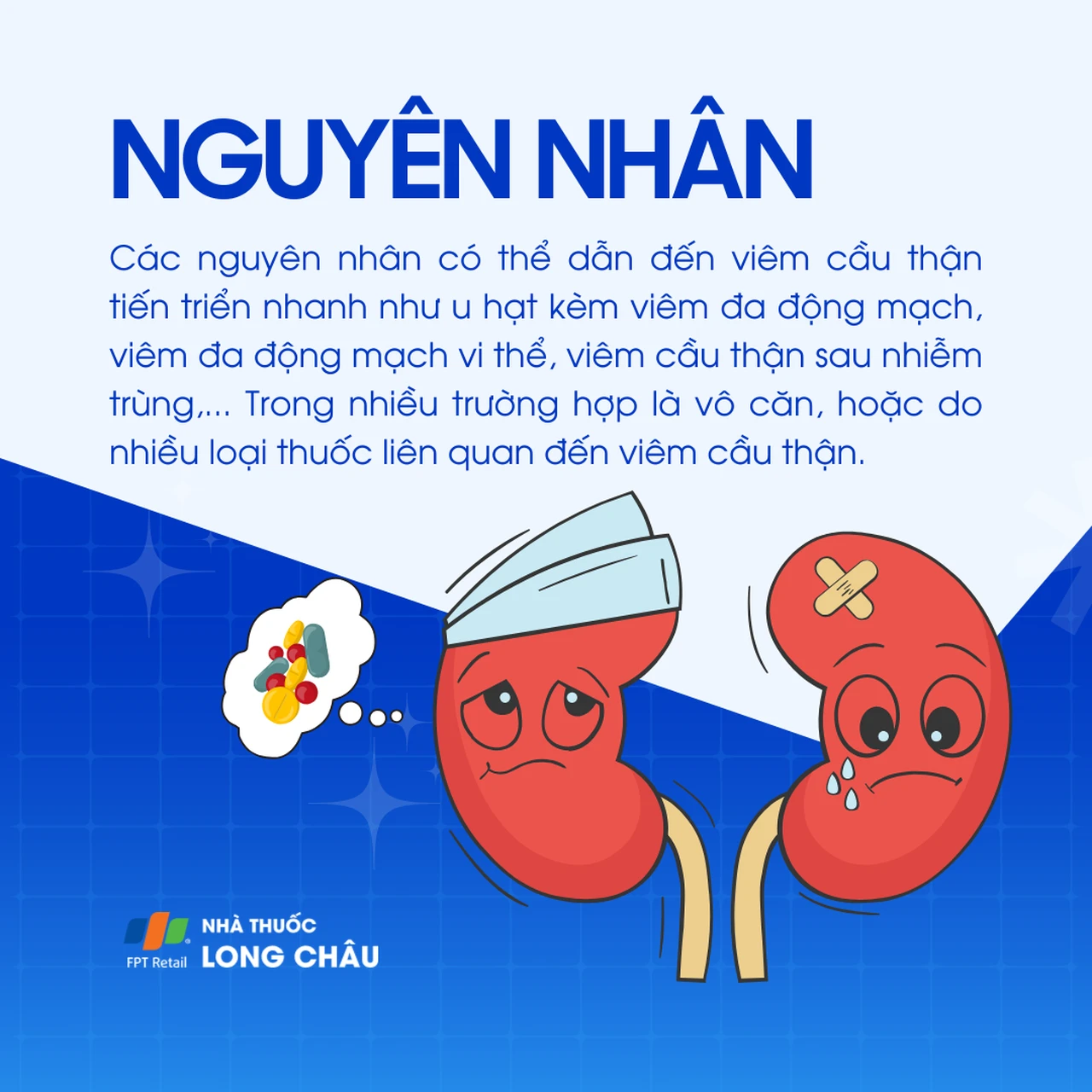 Viêm cầu thận tiến triển nhanh 3