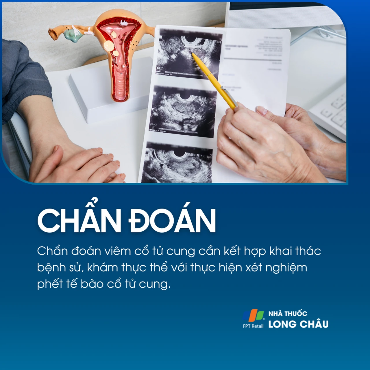 Viêm cơ tử cung 5