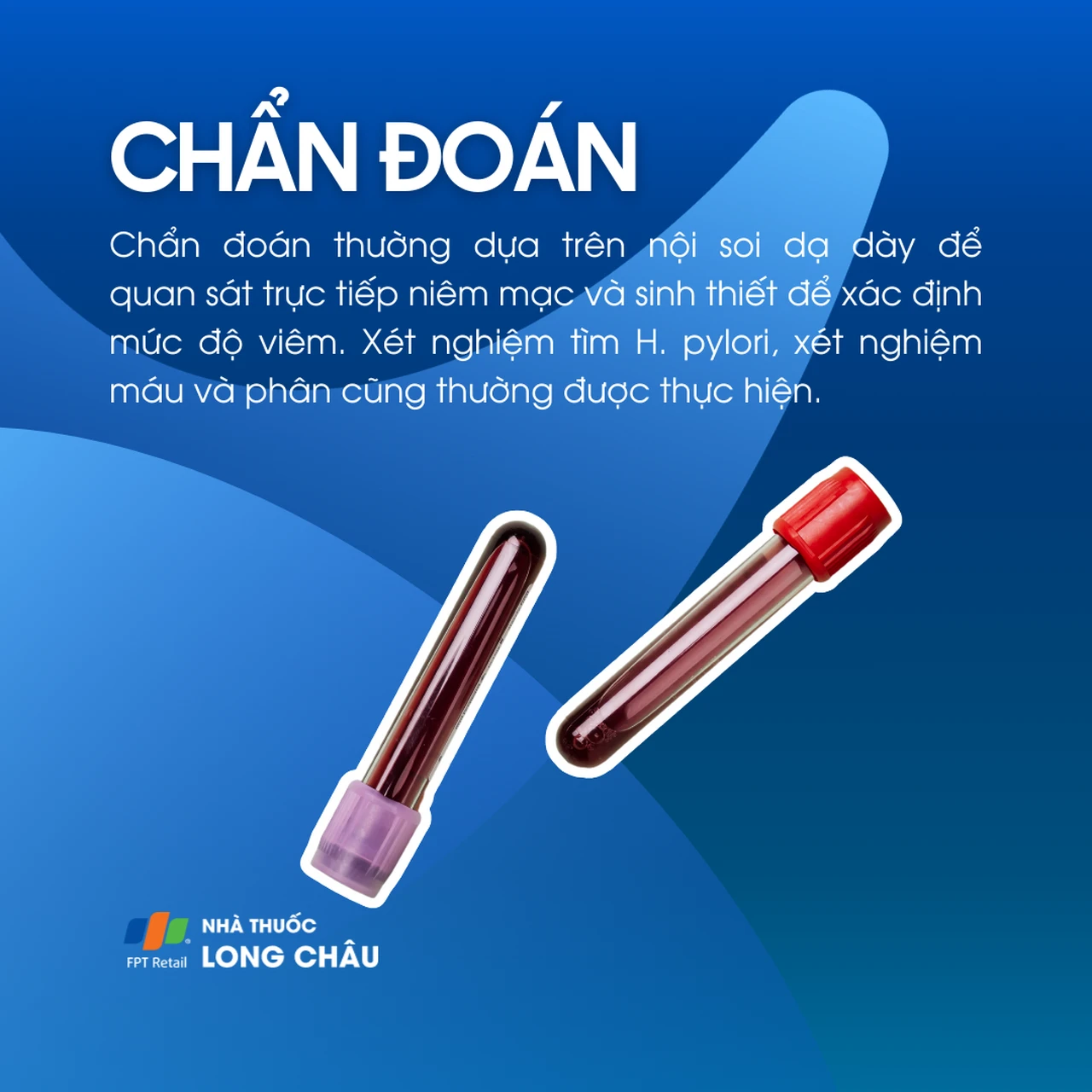 Viêm dạ dày mạn tính 5