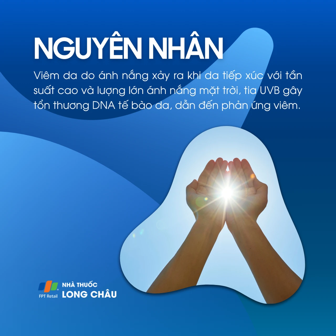 Viêm da do ánh nắng 3