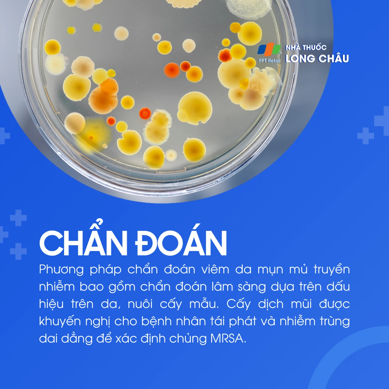 Viêm da mụn mủ truyền nhiễm 5