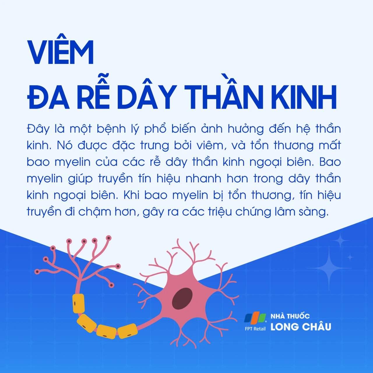 Viêm đa rễ dây thần kinh 1