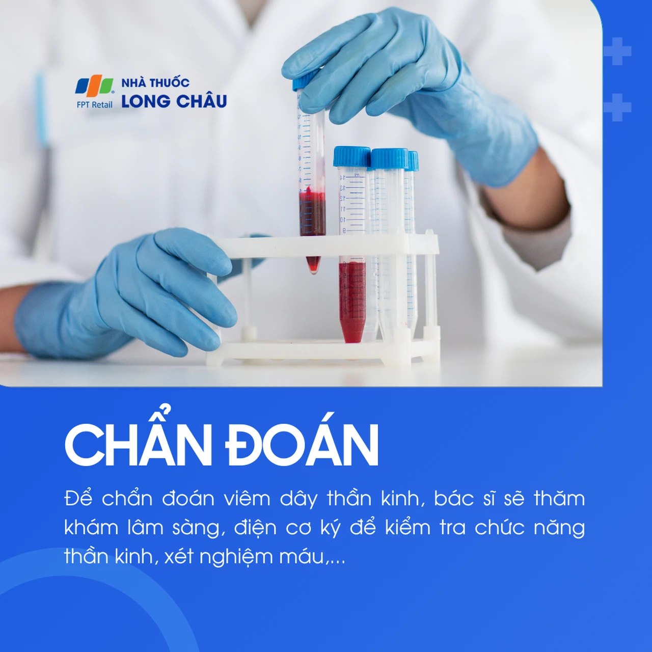 Viêm dây thần kinh 5
