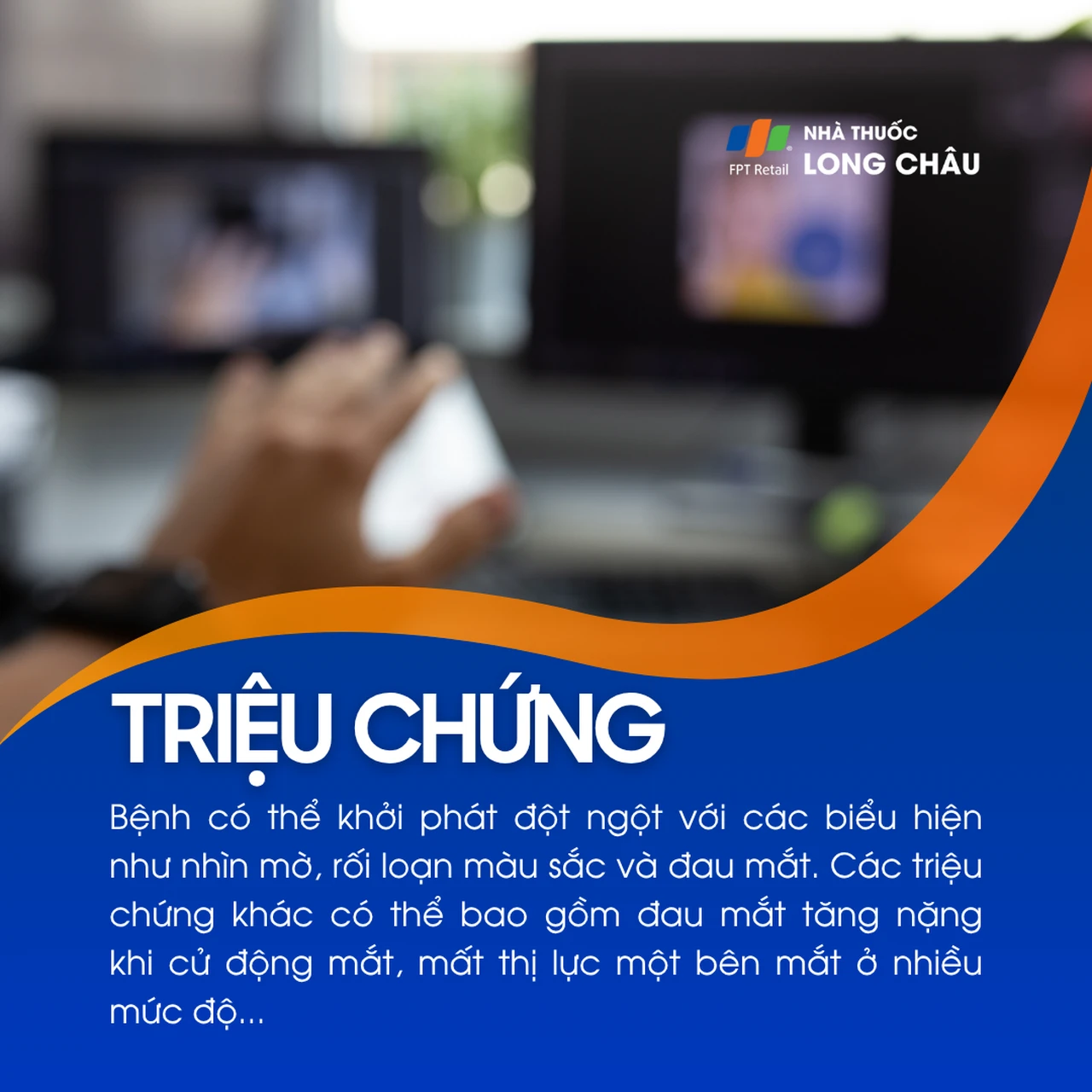 Viêm dây thần kinh thị giác 2