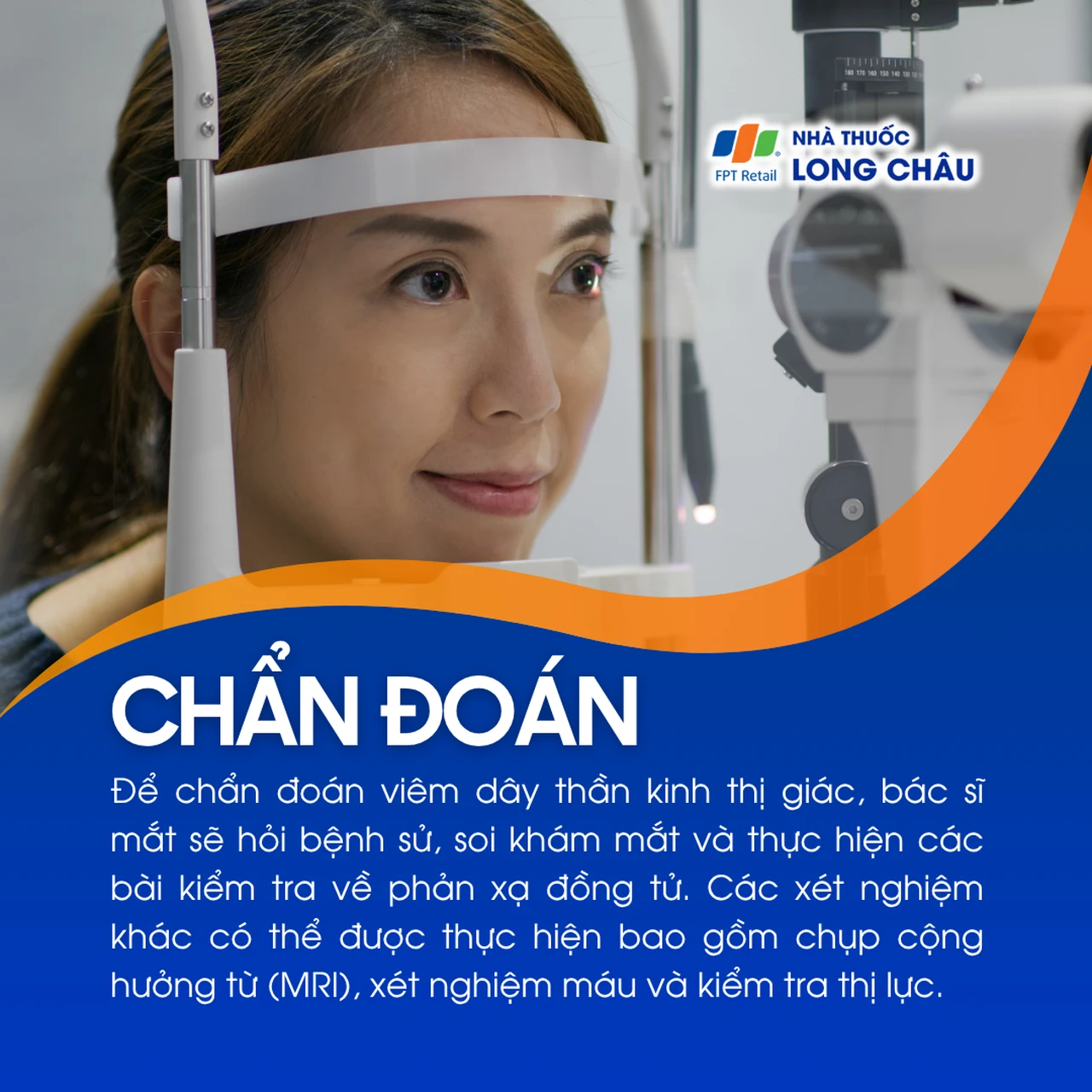 Viêm dây thần kinh thị giác 5