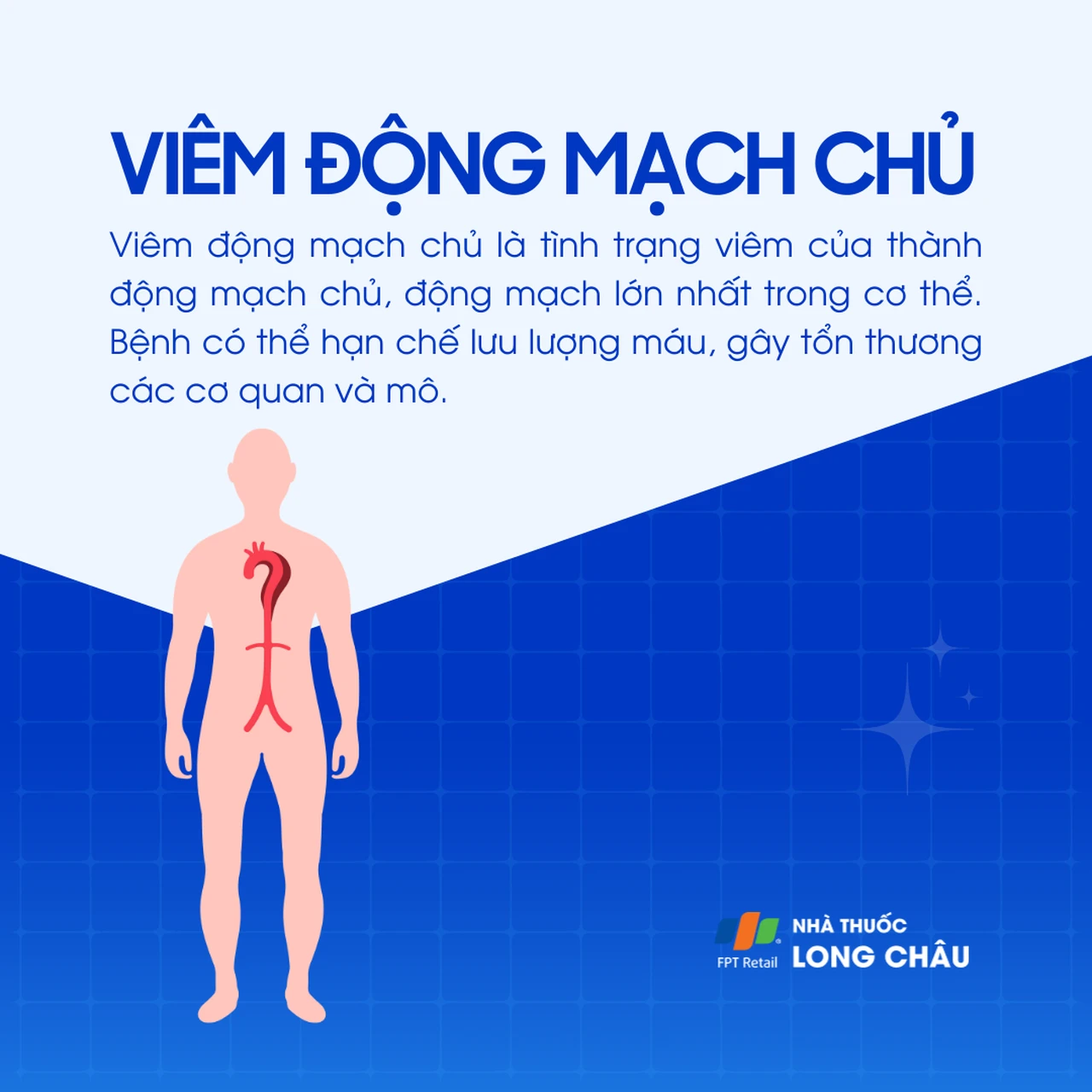 Viêm động mạch chủ 1