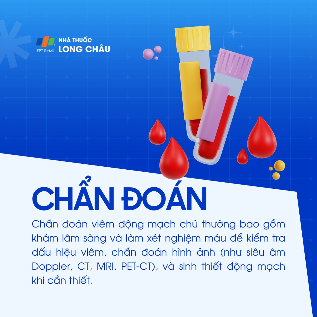 Viêm động mạch chủ 5