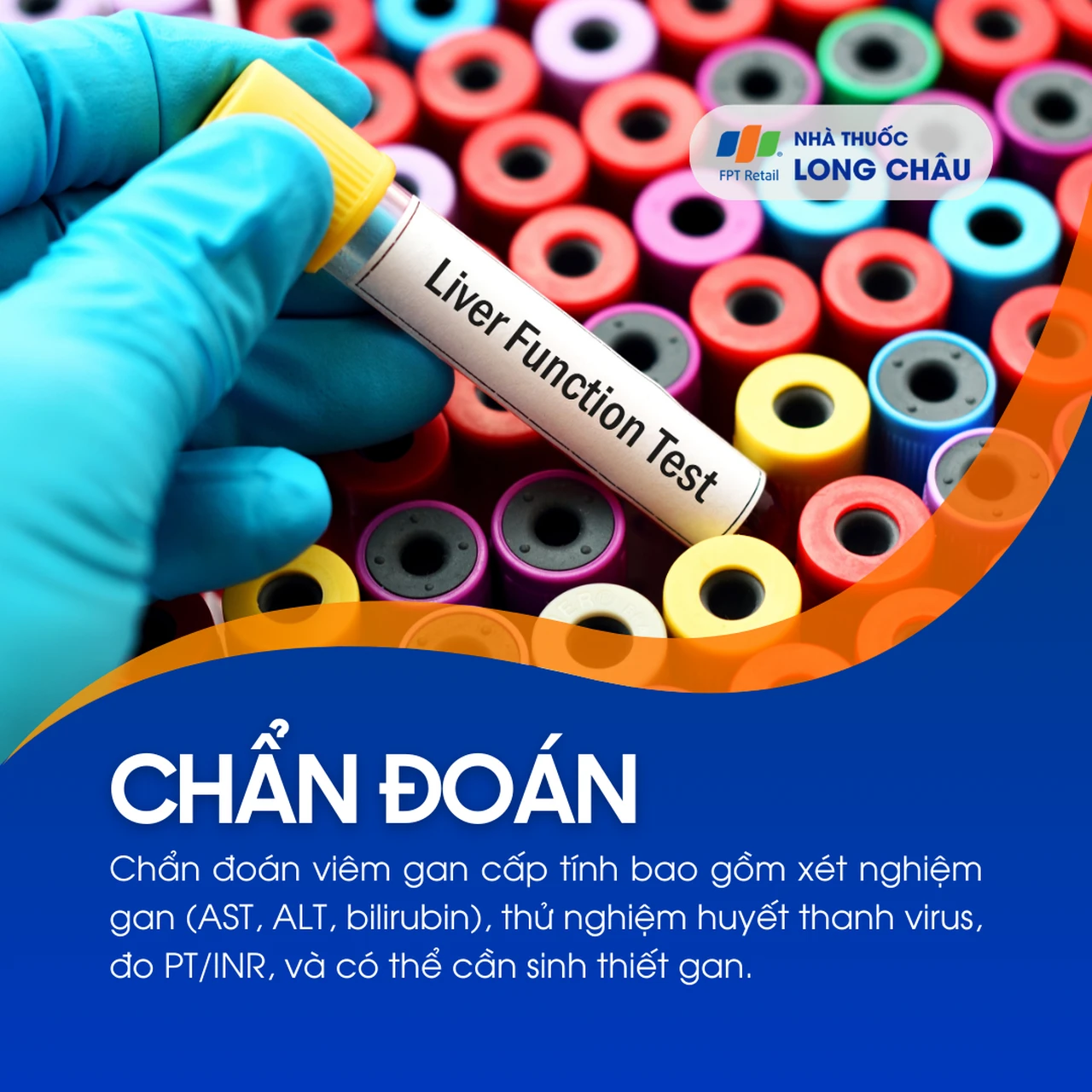Viêm gan cấp tính 5