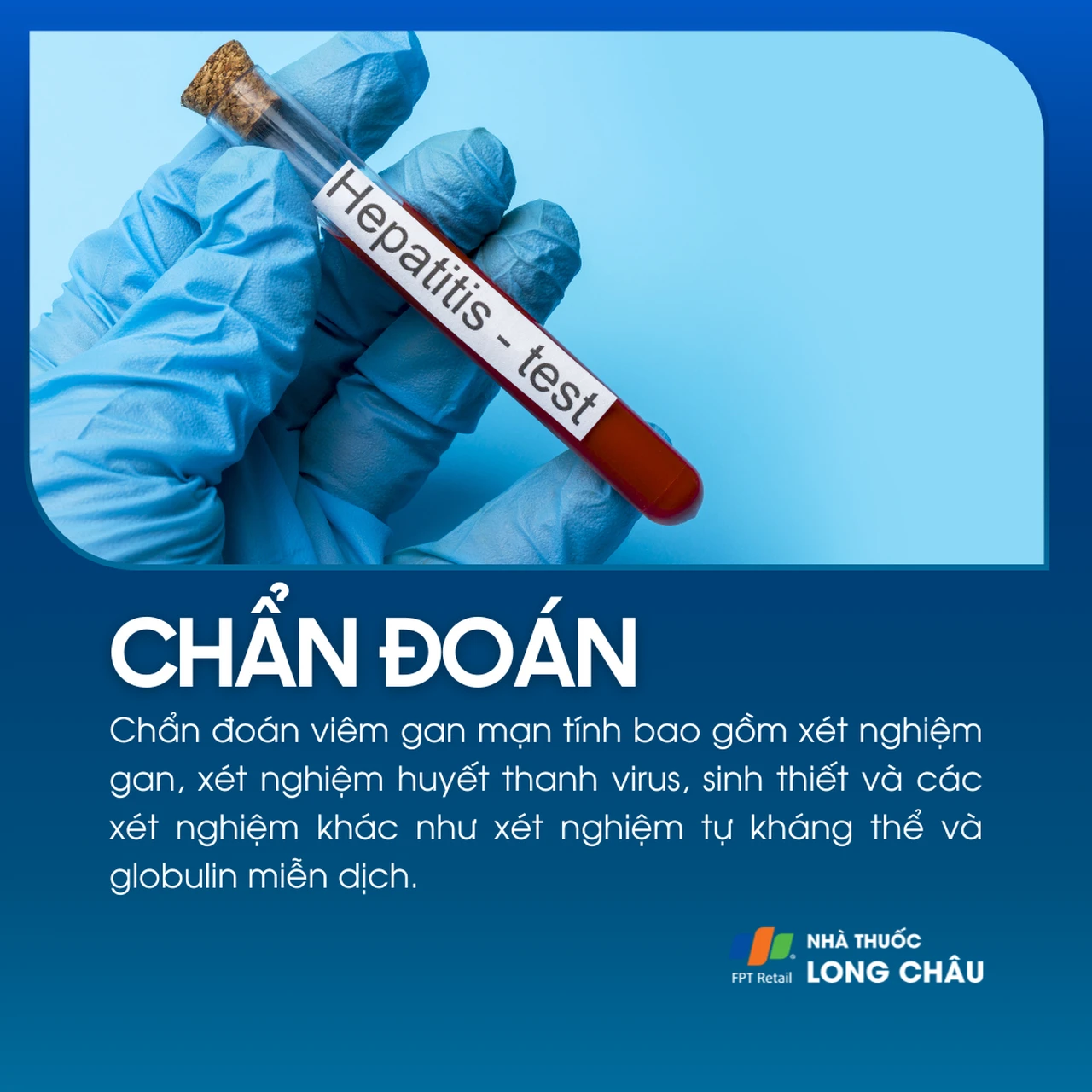 Viêm gan mạn tính 5