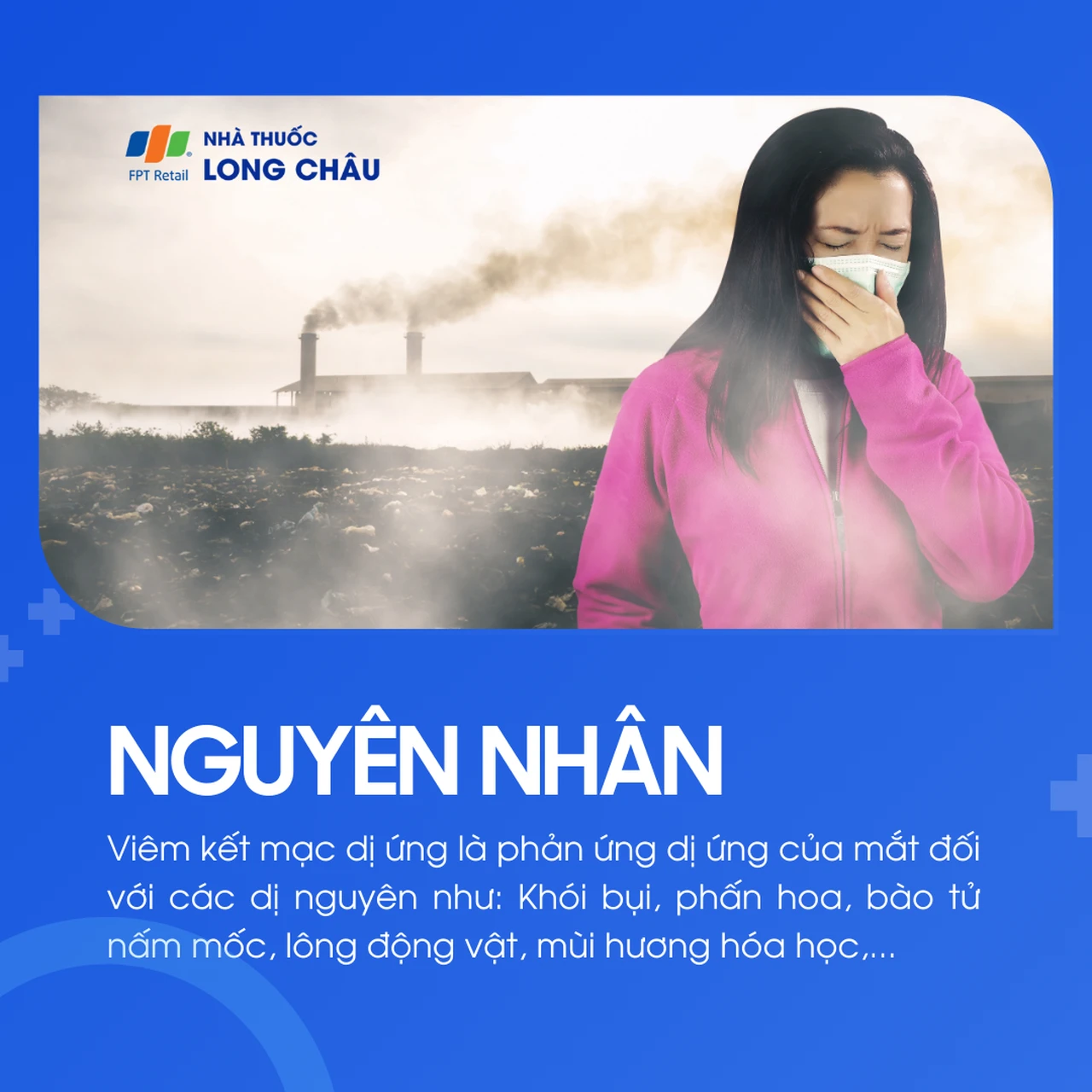 Viêm kết mạc dị ứng 3