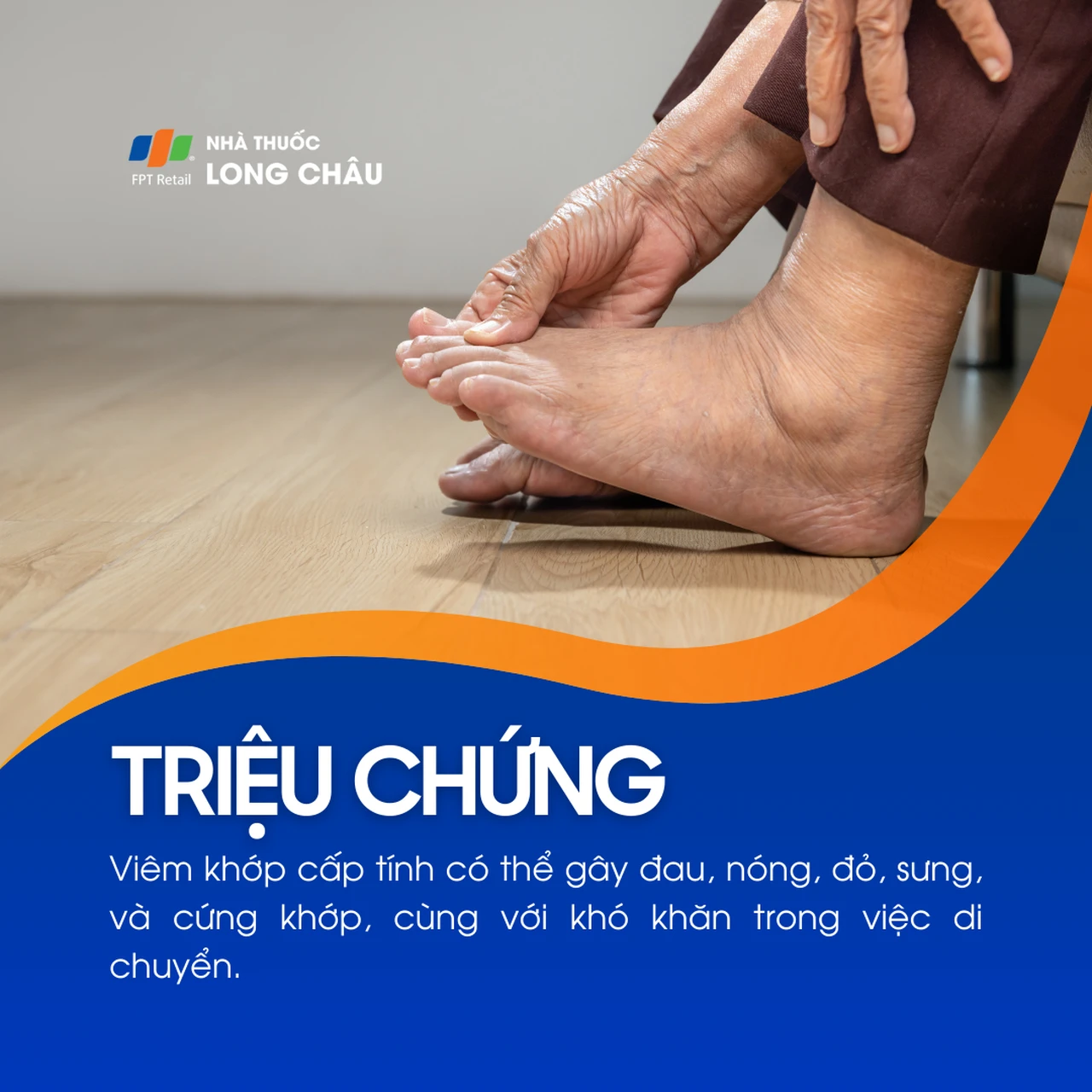 Viêm khớp cấp 2