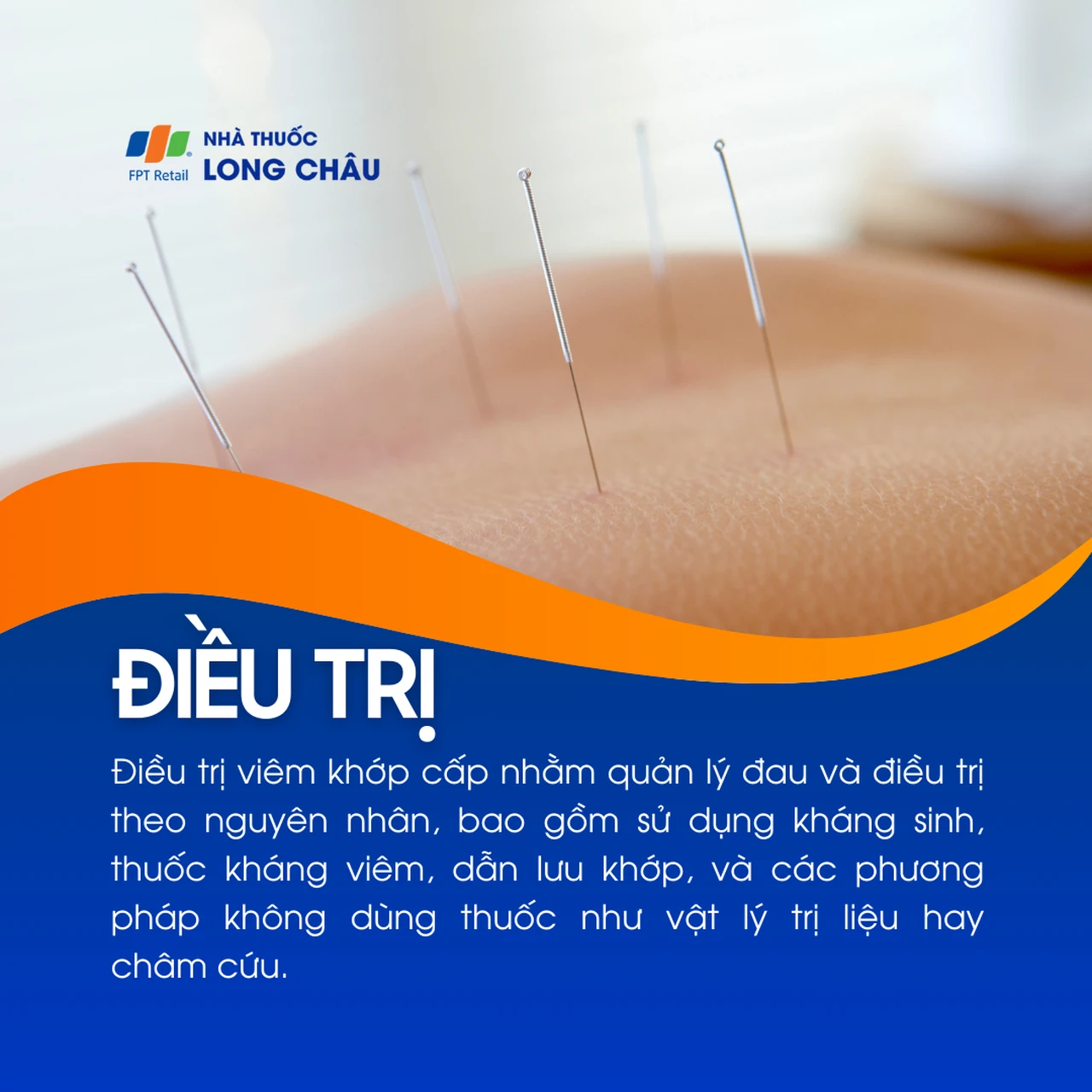 Viêm khớp cấp 6