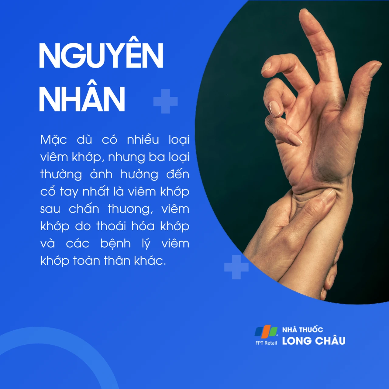 Viêm khớp cổ tay 3