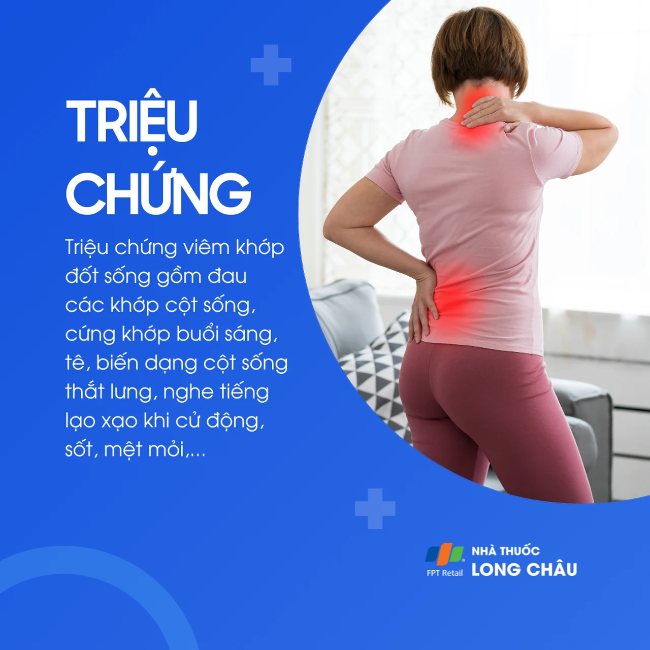 Viêm khớp đốt sống 2