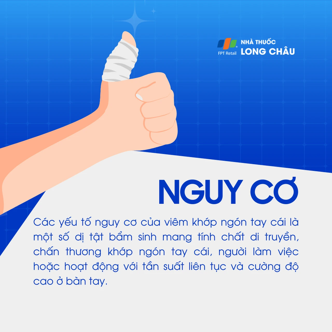 Viêm khớp ngón tay cái 4