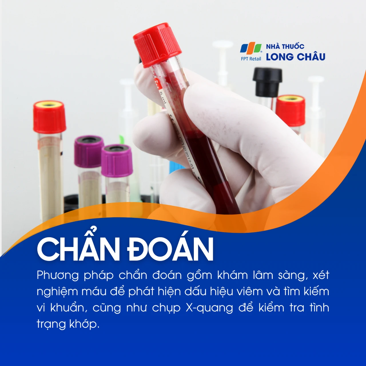 Viêm khớp phản ứng 5