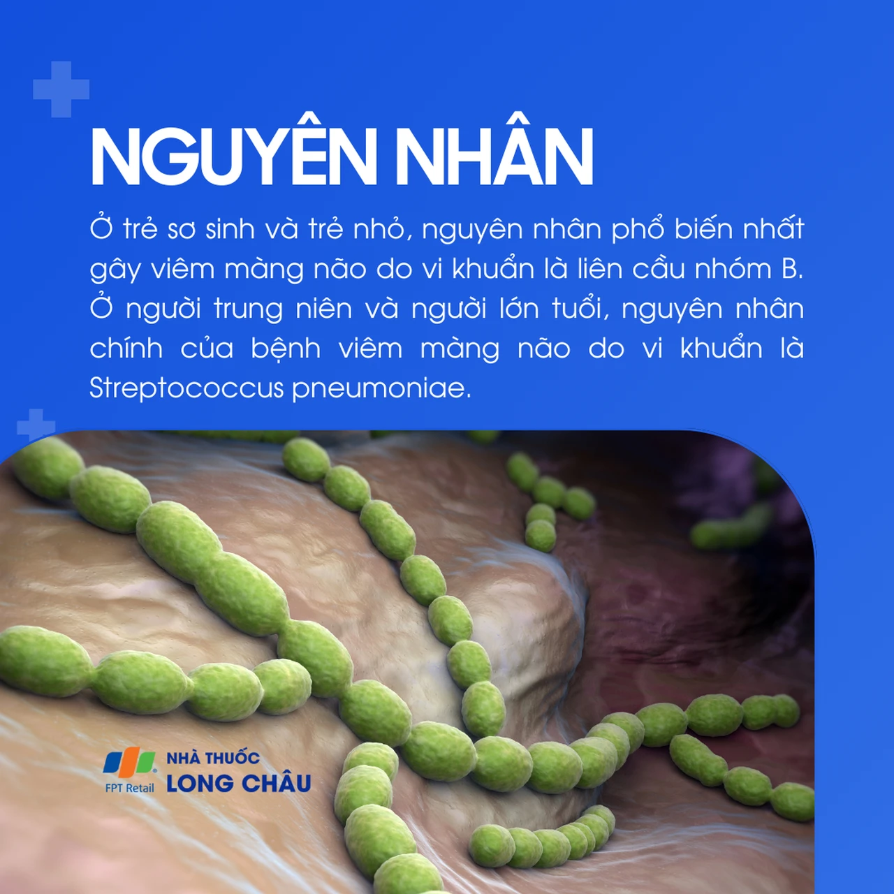 Viêm màng não do liên cầu khuẩn 3