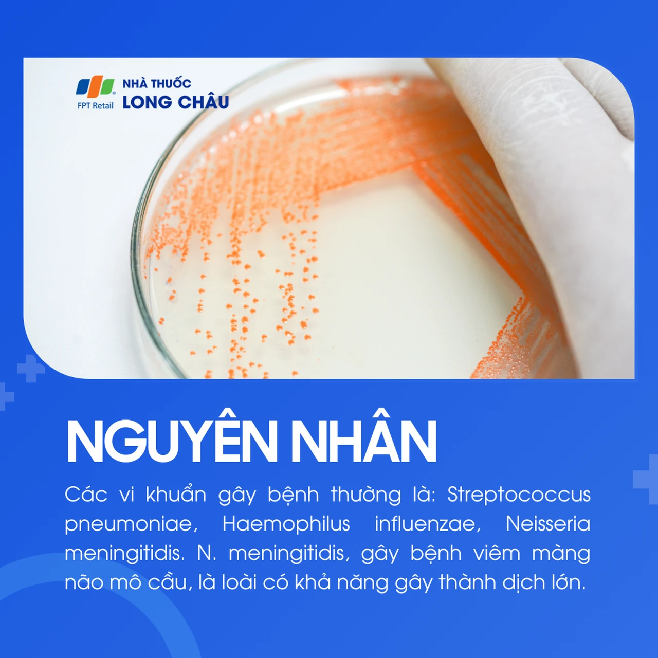 Viêm màng não do phế cầu 3