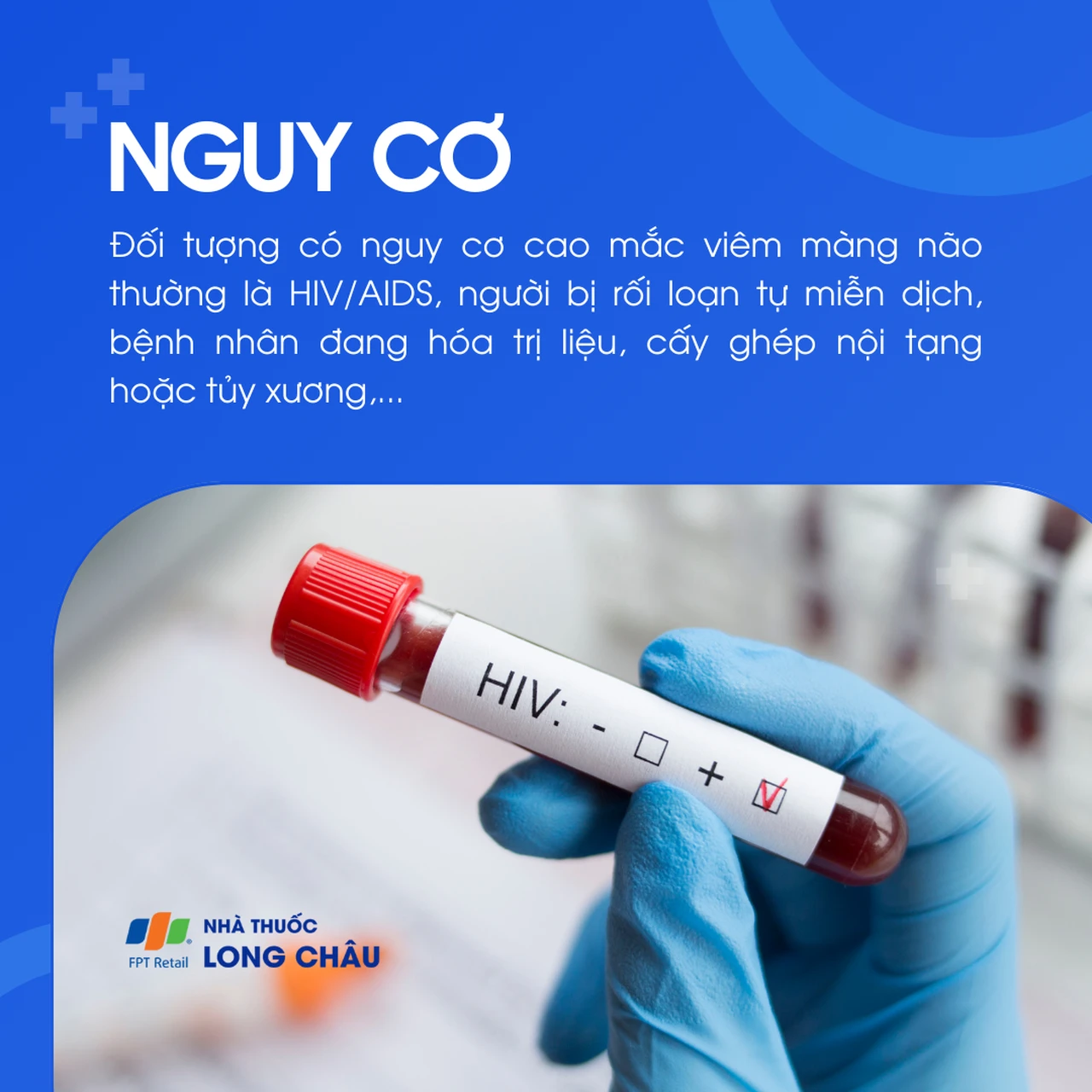 Viêm màng não do phế cầu 4