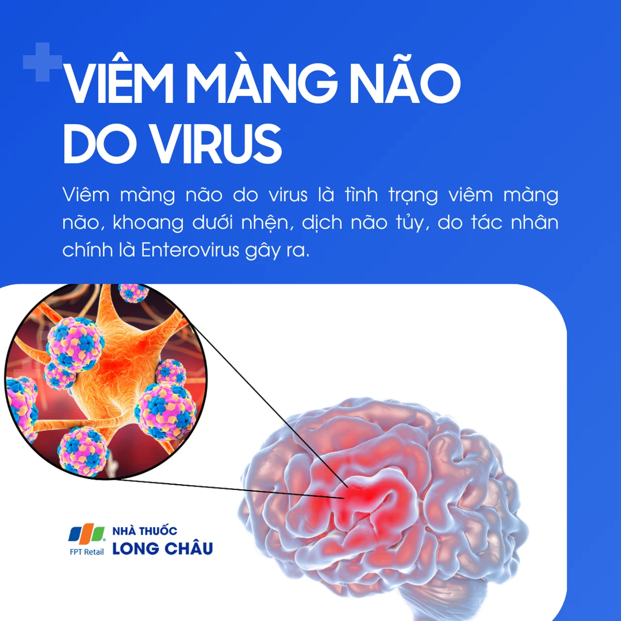 Viêm màng não do virus 1