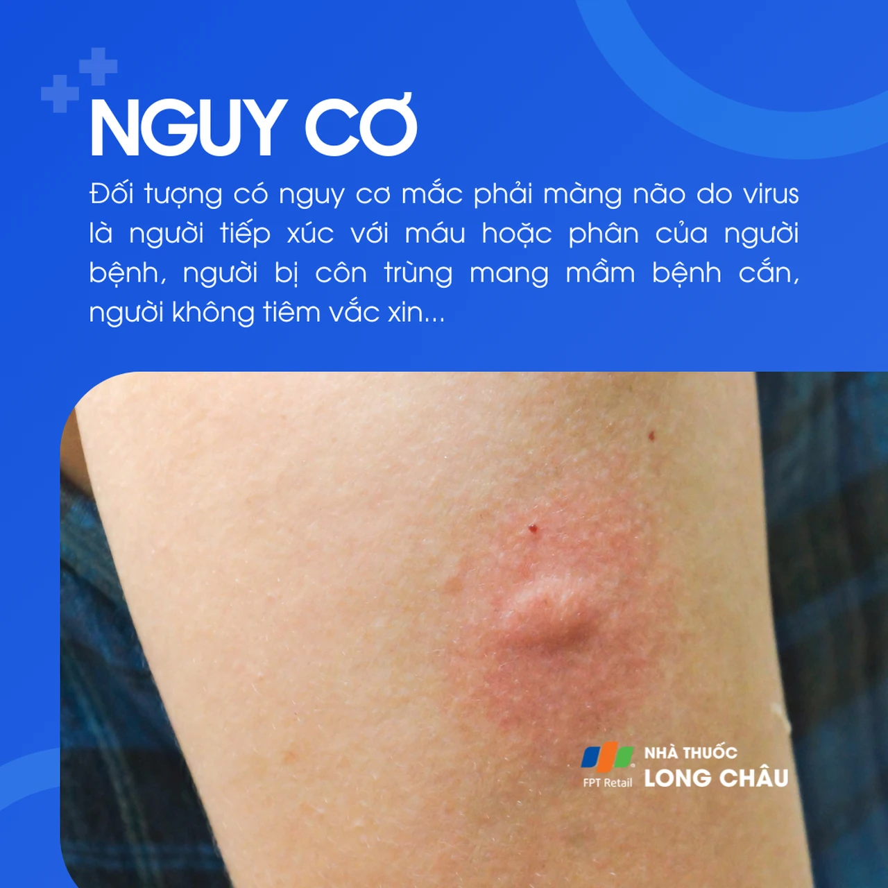 Viêm màng não do virus 4